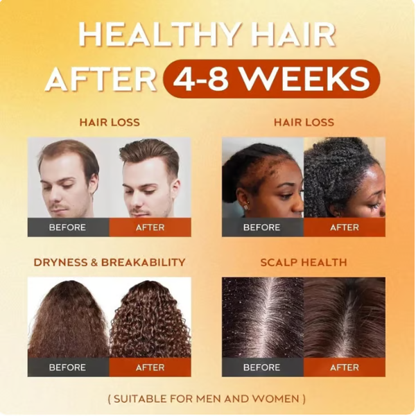 Batana Oil for Hair Growth,Raw Organic Batana Mask from Honduras🌱